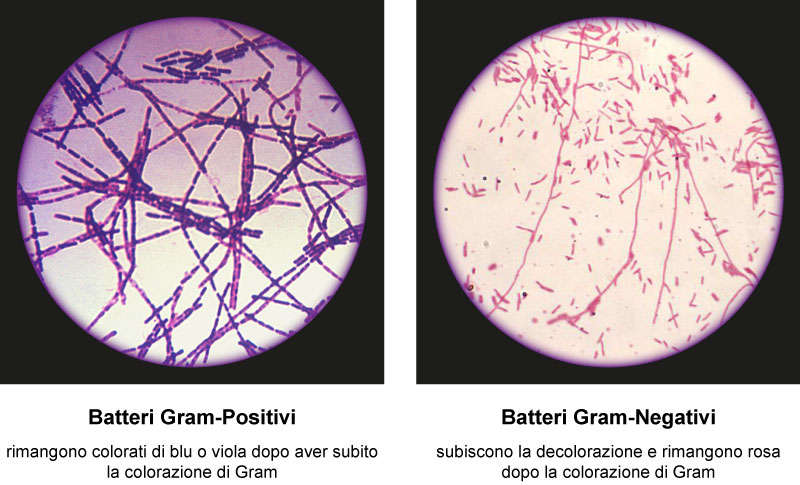 batteri gram-positivi e gram-negativi