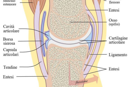 artrite psoriasica