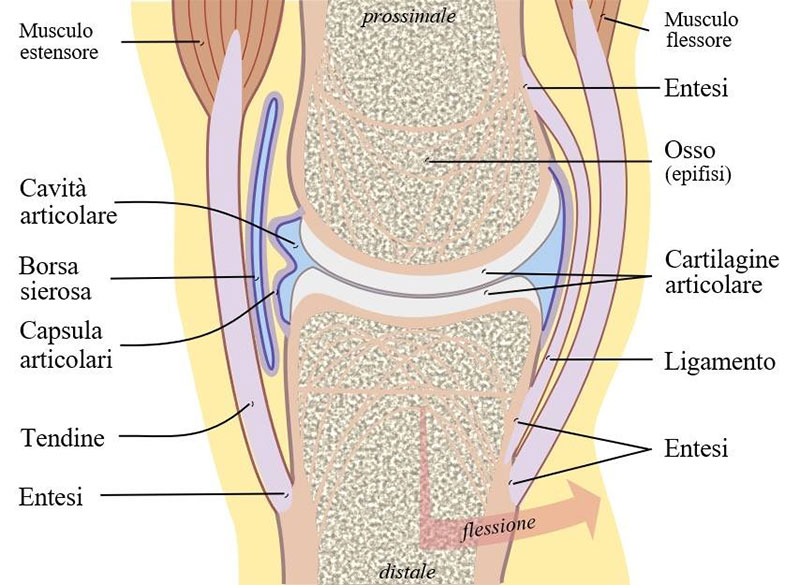 artrite psoriasica