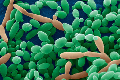 candida tropicalis