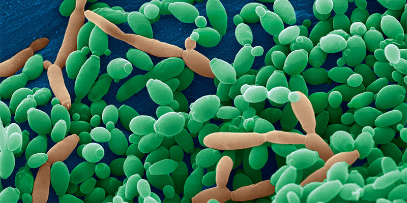 candida tropicalis