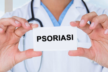 varie forme psoriasi fattori scatenanti rimedi