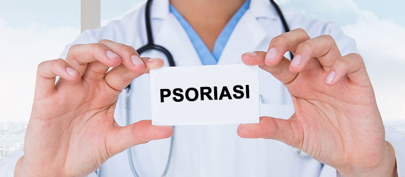 varie forme psoriasi fattori scatenanti rimedi