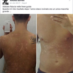 testimonianze