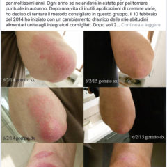testimonianze