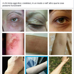 testimonianze