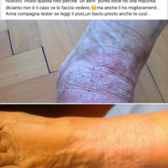 testimonianze