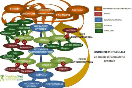 Sindrome Metabolica