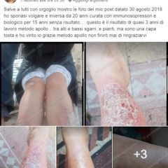 testimonianze